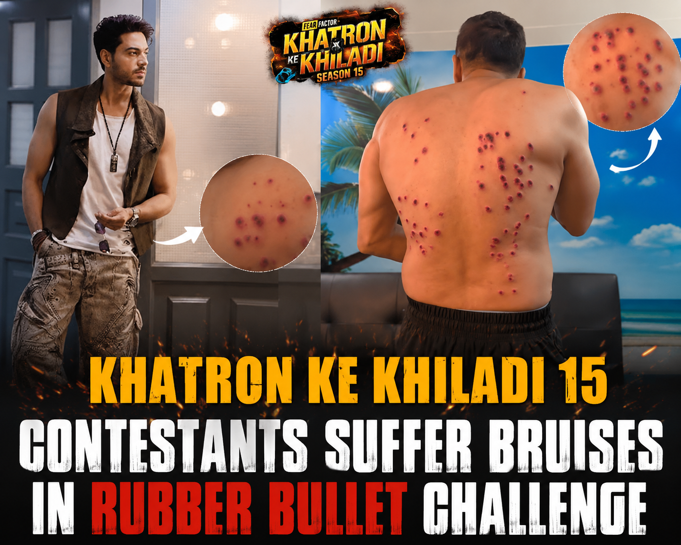 Khatron Ke Khiladi 15 Contestants Suffer Bruises in Rubber Bullet Challenge